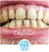 CALCULUS